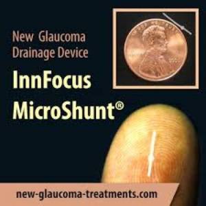 InnFocus Inc.